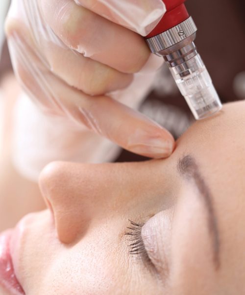 Ravin Skin Treatments 9