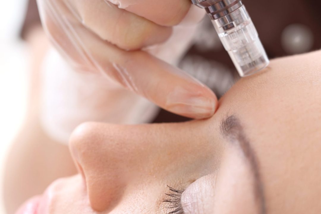 Ravin Skin Treatments 9